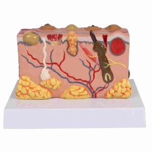 Anatomisch Model Huid met Ziektebeelden