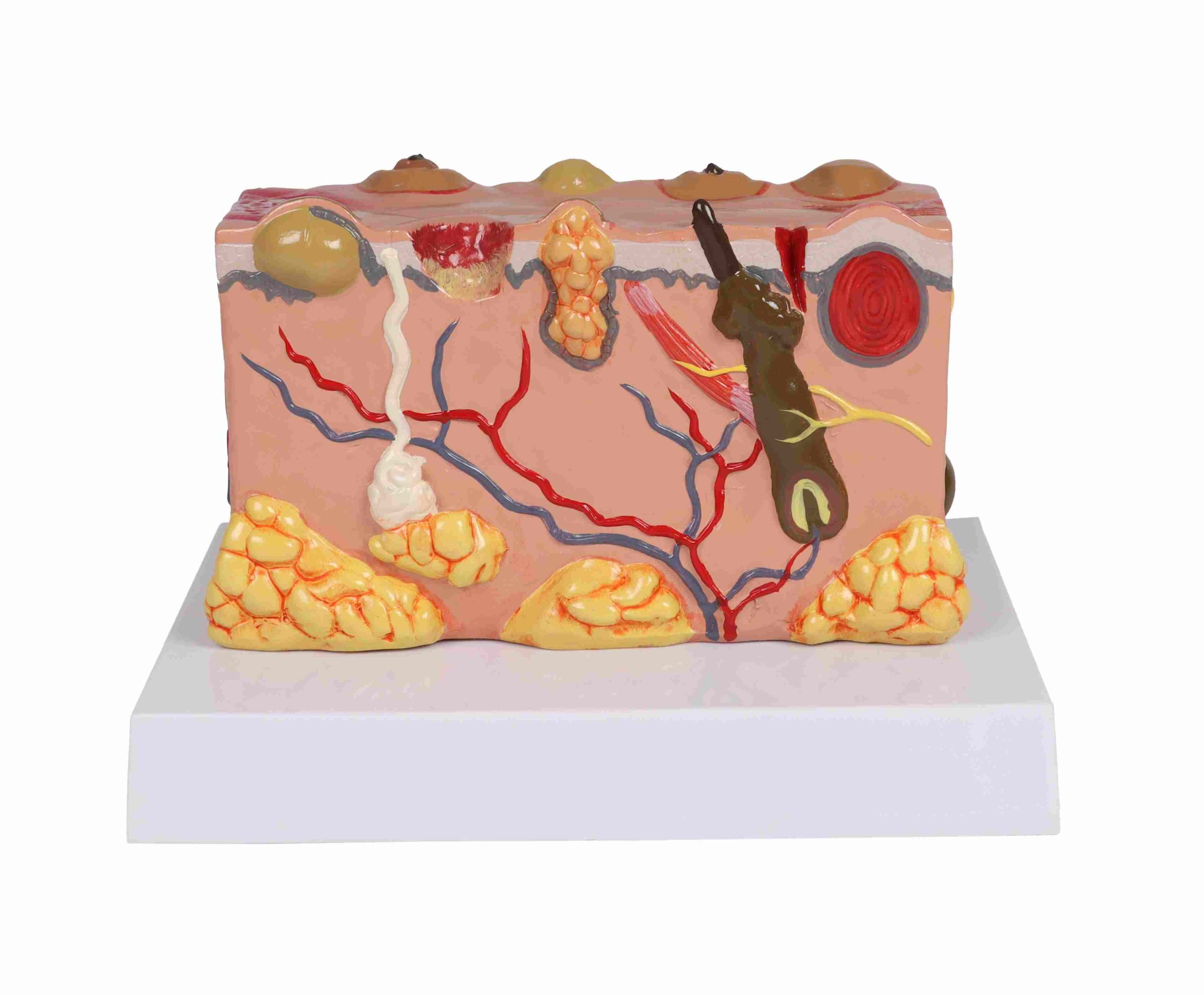 Anatomisch Model Huid met Ziektebeelden