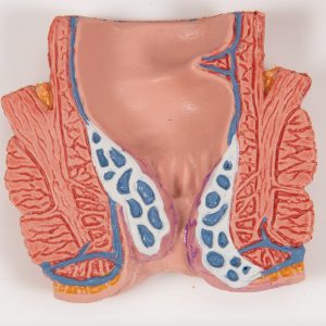Aambei model