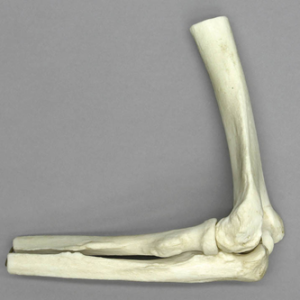 Anatomisch Model Ellebooggewricht