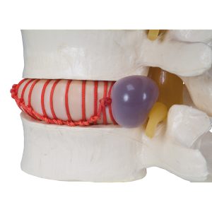 Hernia Simulator