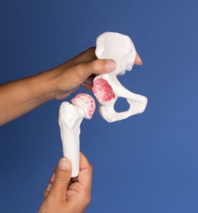 Heupimplantaat Model