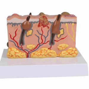 Anatomisch Model Huid met Ziektebeelden