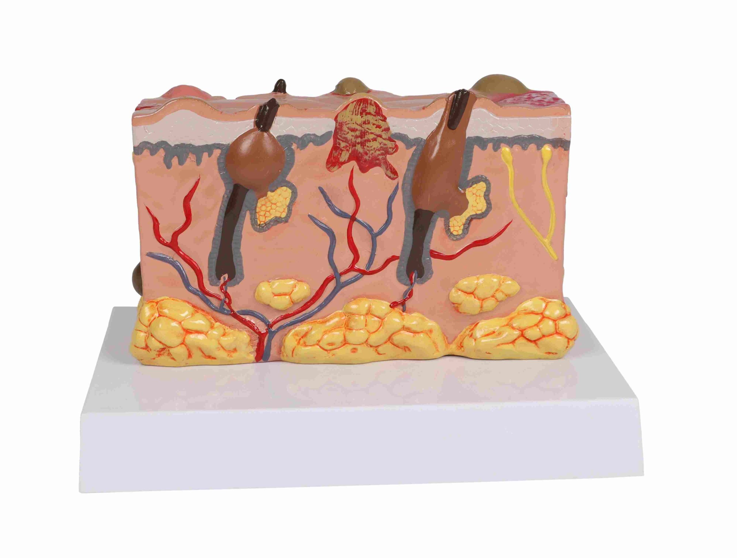Anatomisch Model Huid met Ziektebeelden