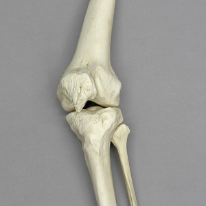 Anatomisch Model Kniegewricht