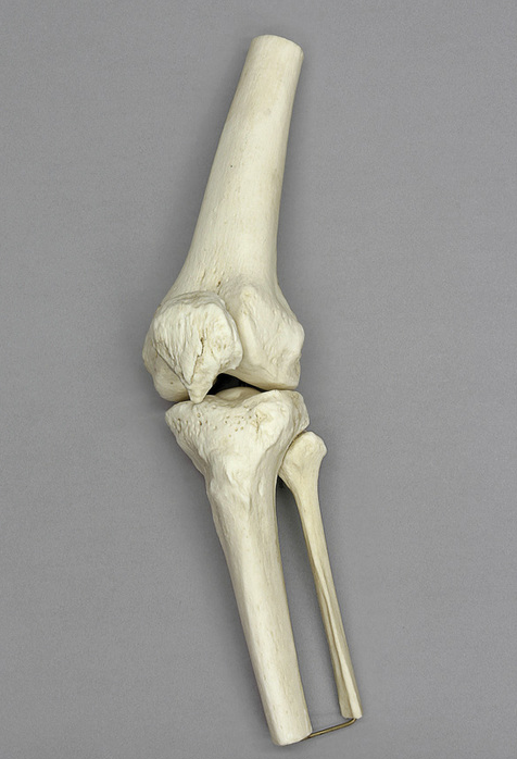 Anatomisch Model Kniegewricht