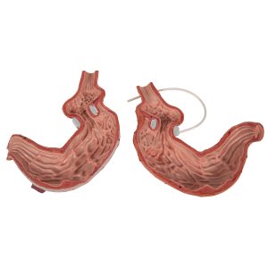 Maagband Model