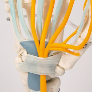 Handmodel met Pezen, Zenuwen en Carpaal Tunnelsyndroom