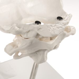 Atlas, draaier & occipitaal bot