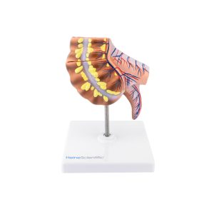 Blinde Darm en Wormvormig Aanhangsel Model