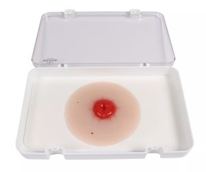 Colostomie Wondmodel, Zelfklevend