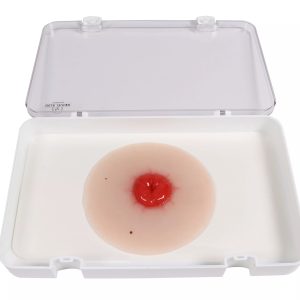 Colostomie Wondmodel, Zelfklevend