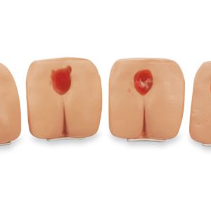 Decubitus Modellen Set (4 stuks)