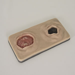 Decubitus Rug Trainingsmodel