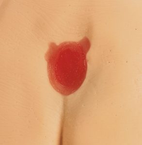 Decubitus Modellen Set (4 stuks)