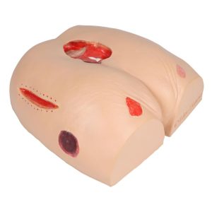 Decubitus Verzorgingsmodel