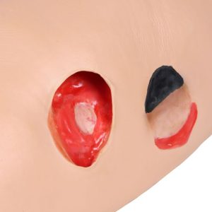 Decubitus Verzorgingsmodel