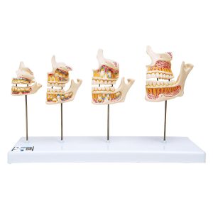 Dentale ontwikkeling