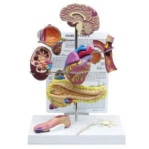 Diabetes Type 2 Model
