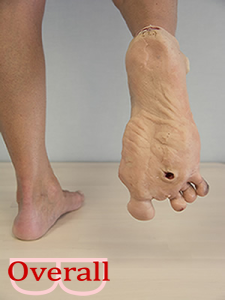 Draagbaar Diabetisch Voetmodel