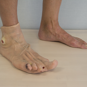 Draagbaar Diabetisch Voetmodel