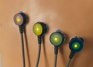 ECG Trainingsmodel