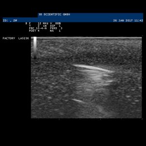 Echografie Oefenmodel Corpus Alienum