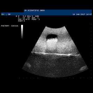 Echografie Trainer Adermodel