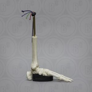 Enkelverstuiking Model