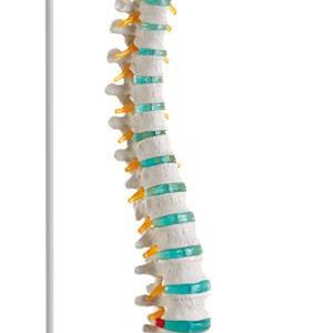 Flexibel Wervelkolom Model, Budget
