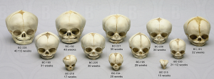 Foetus set van 12 schedels op standaard