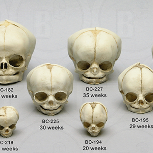 Foetus set van 12 schedels op standaard
