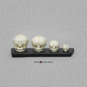 Foetus Schedel Set, 4-delig, met Lesplan