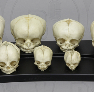 Foetus set van 12 schedels op standaard