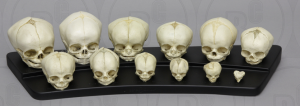 Foetus set van 12 schedels op standaard