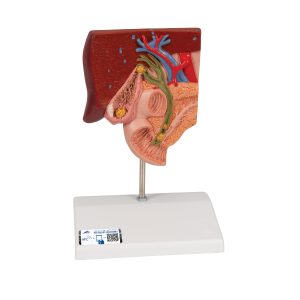 Galsteen model