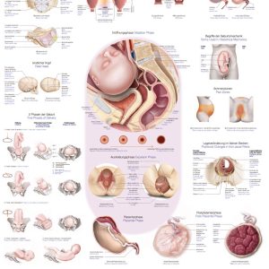 Anatomie Poster Geboorte, 70 x 100 cm