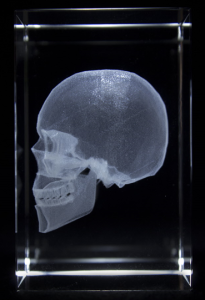 Anatomie Glasblok Schedel