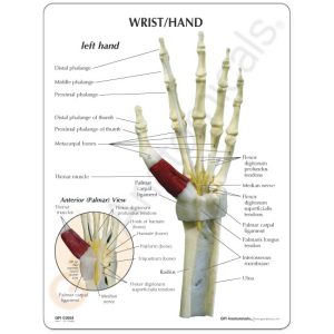 Hand/Pols met Carpaaltunnel syndroom