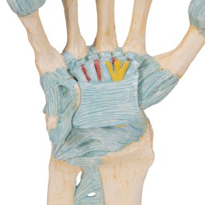 Hand met gewrichtsbanden & Carpale tunnel