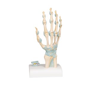 Hand met gewrichtsbanden & Carpale tunnel