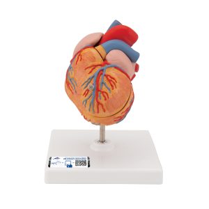 Klassiek hart met linker ventrikel hypertrofie(LHV) 2-delig