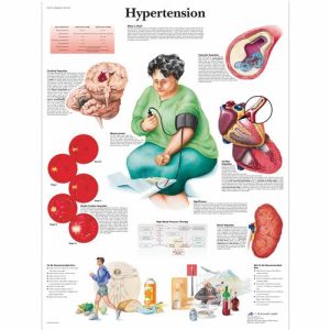 Hoge Bloeddruk (Hypertensie) Poster Gelamineerd