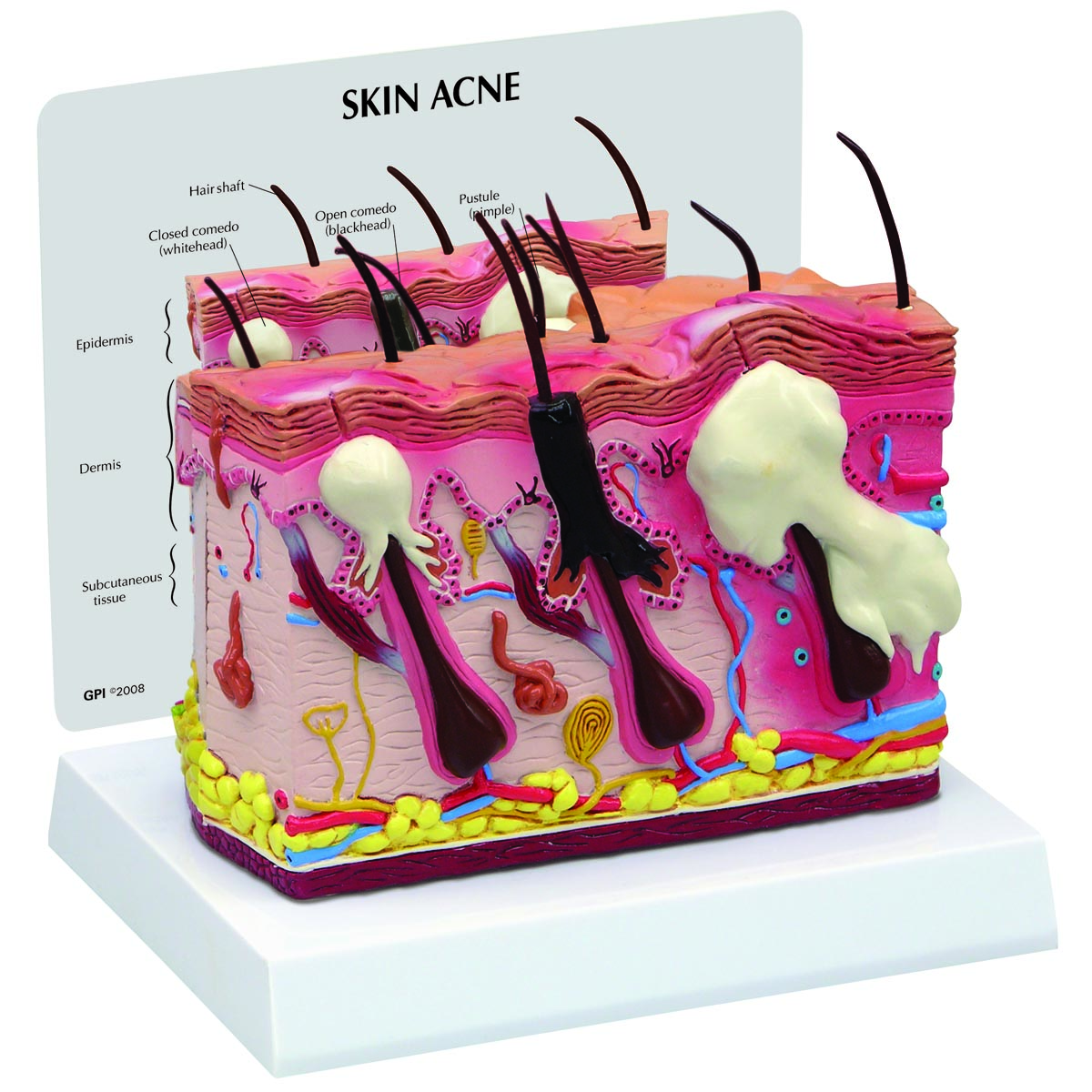 Huidacne Model, Dubbelzijdig