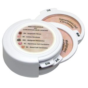 Huidkanker Schijven Set