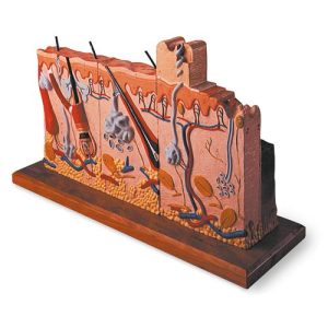 Huidmodel Serie met Brandwonden