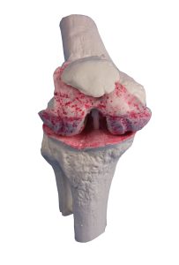 Knie-implantaat model