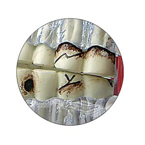 Kaakgewricht