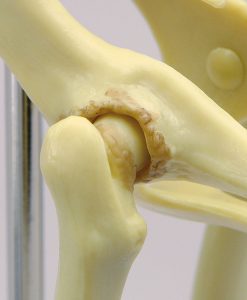 Bekkenmodel Kat