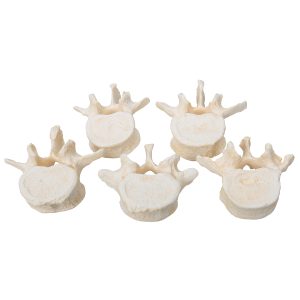 set van 5 losse Lumbale wervels, BONElike